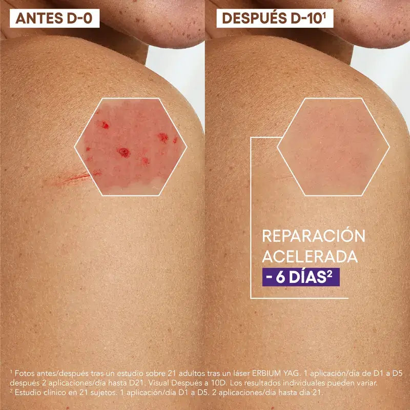 A-Derma Epitheliale AH Ultra – upokojujúci regeneračný krém proti pigmentovým škvrnám, 40 ml