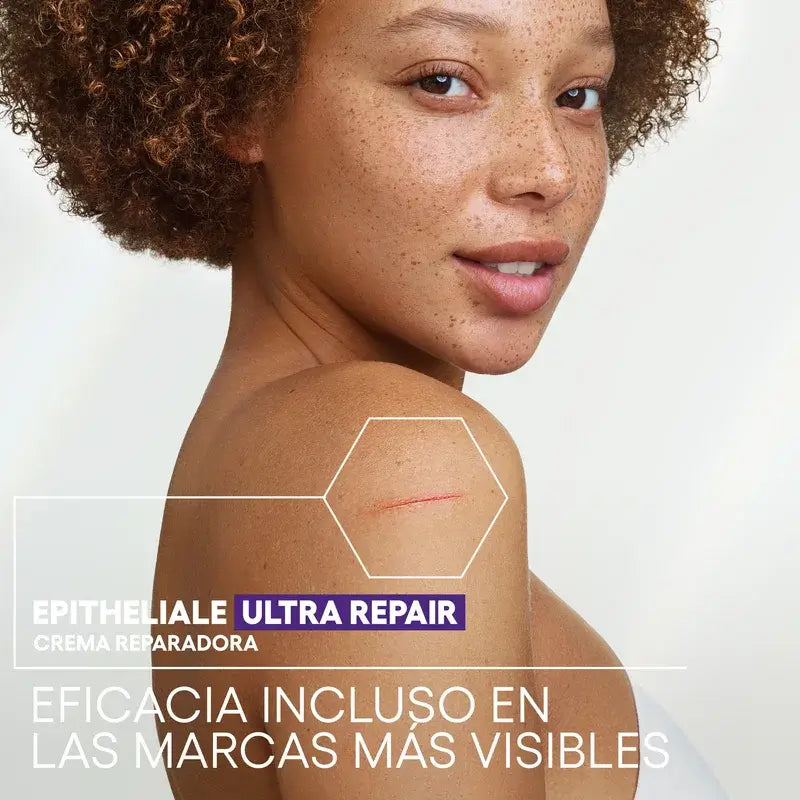 A-Derma Epitheliale AH Ultra – upokojujúci regeneračný krém proti pigmentovým škvrnám, 40 ml