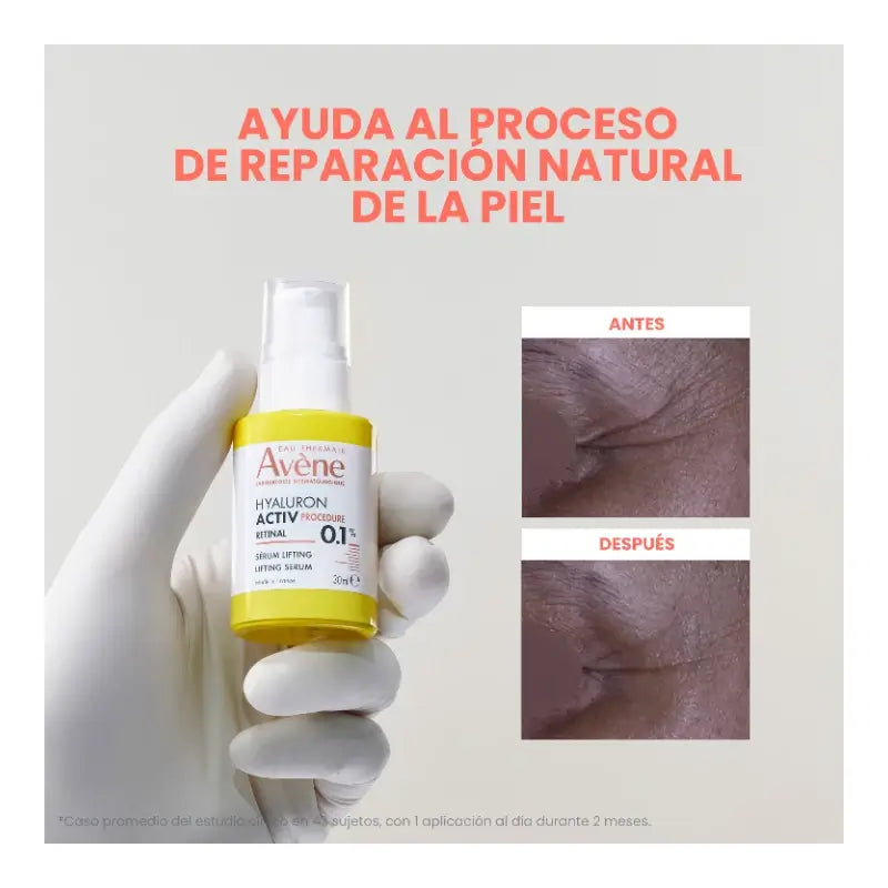 Avène Hyaluron Activ Procedure Liftingové sérum s 0,1 % retinalom, 30 ml