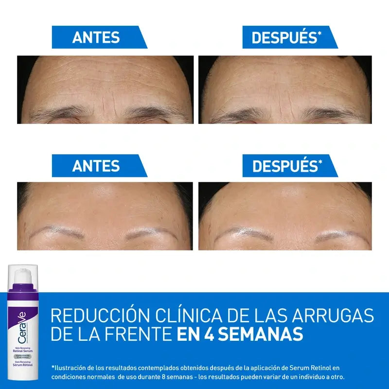 Cerave Skin Renewing – sérum s retinolom proti starnutiu, 30 ml