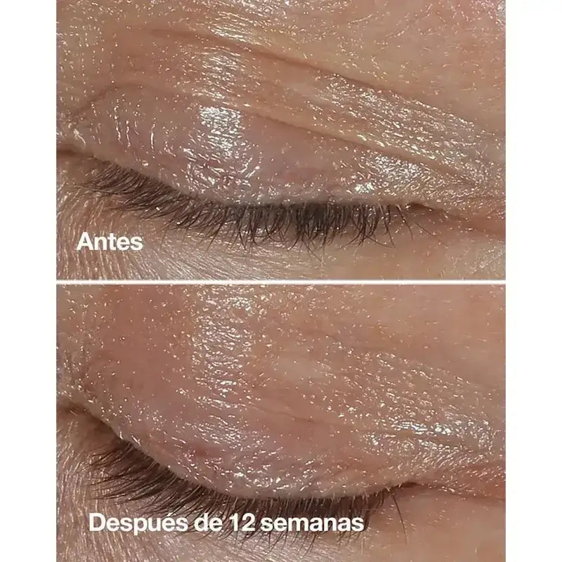 Clinique Smart Clinical Repair – korekčný krém proti vráskam na oblasť okolo očí, 2x15 ml