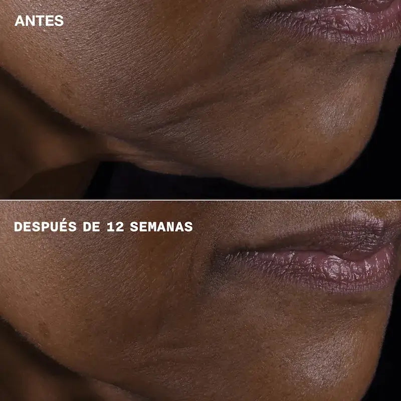 Clinique Smart Clinical Repair – pevnosť + lifting pre tvár a krk, 75 ml