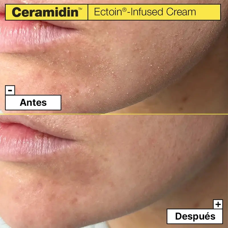 Dr. Jart+ Ceramidin Hydratačný krém na tvár s ektoínom, 50 ml