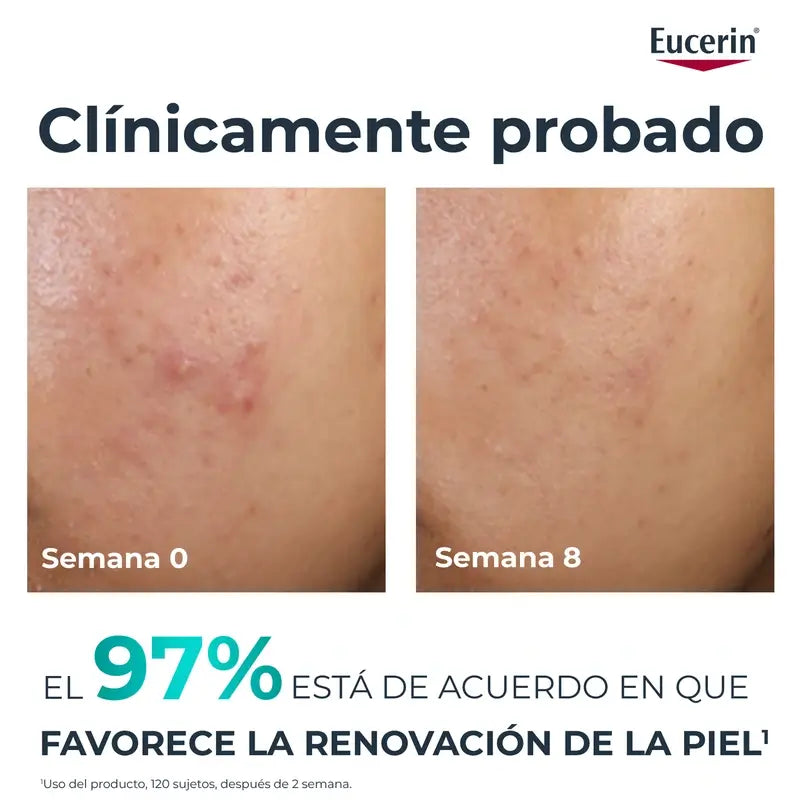 Eucerin Dermopure Peeling s 10 % hydroxykyselinami, 40 ml