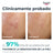 Eucerin Dermopure Peeling s 10 % hydroxykyselinami, 40 ml