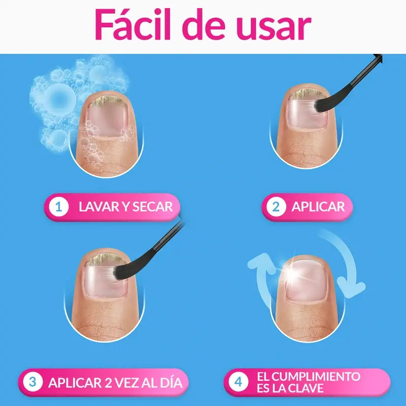 Excilor lak na liečbu plesňových ochorení nechtov, 3,3 ml