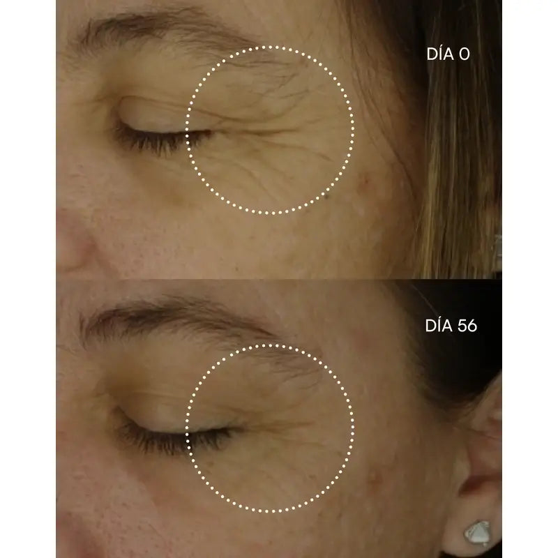Gema Herrerías 0,3 Retinol-NP sérum, 30 ml