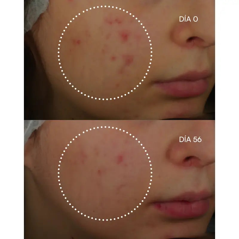 Gema Herrerías 1600 Retinal-Z sérum na nedokonalosti pleti, 30 ml
