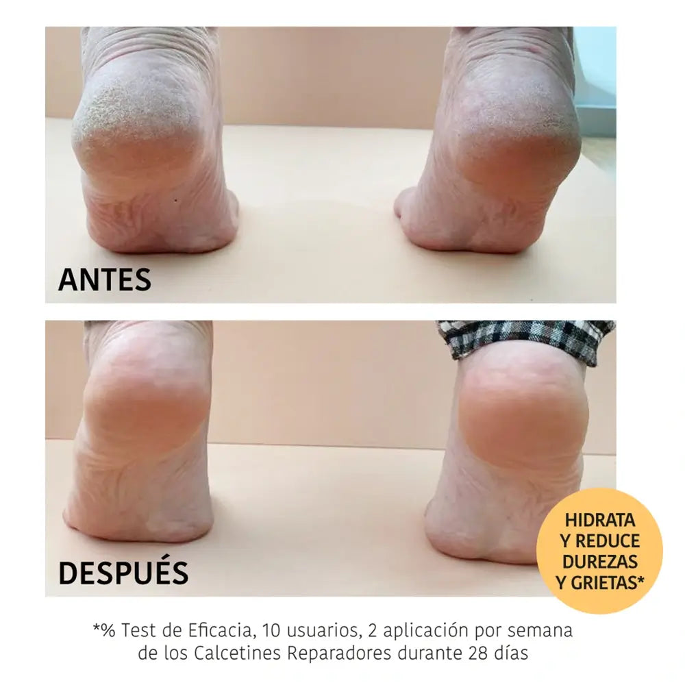 Iroha Nature Telové ponožky – regeneračná maska, 20 ml