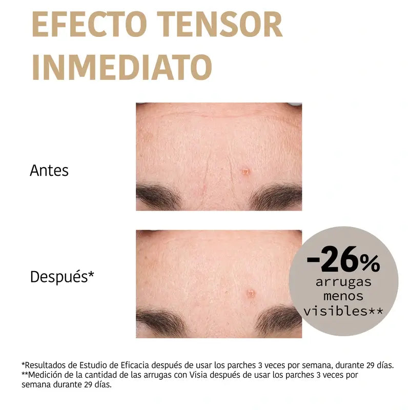Iroha Nature Náplasti na čelo s 99 % kolagénom (3 ks + 1 sprej), 3 páry