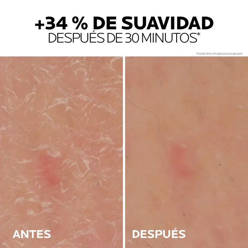 La Roche Posay Lipikar Gel Urea 30 % – hydratačný gél s močovinou, 50 ml