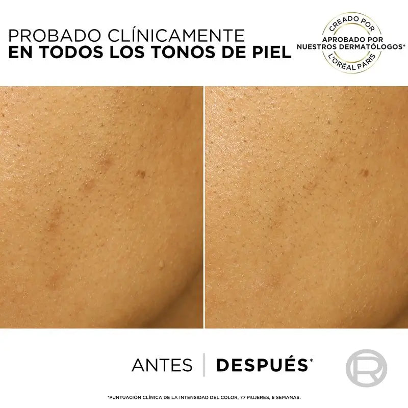 L'Oréal Paris Bright Reveal Peeling – exfoliačný prípravok proti pigmentovým škvrnám