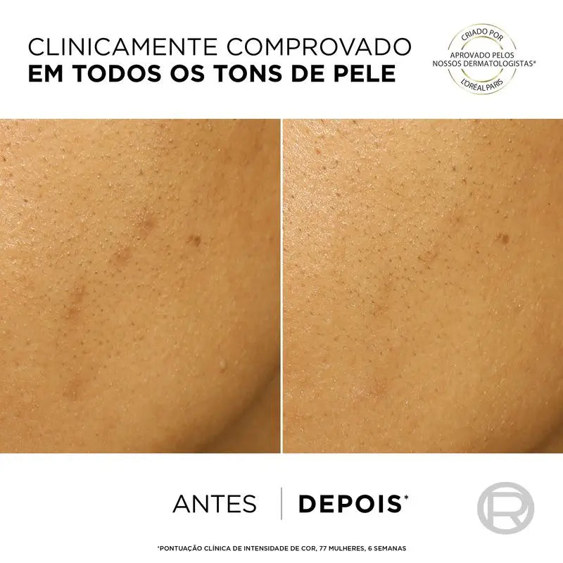 L'Oréal Paris Bright Reveal Peeling – exfoliačný prípravok proti pigmentovým škvrnám