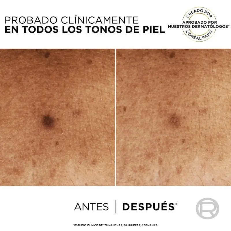 L'Oréal Paris Bright Reveal sérum s niacinamidom proti pigmentovým škvrnám