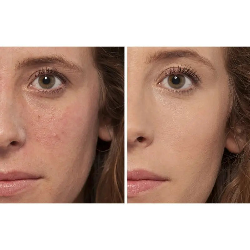 L'Oréal Paris Make Up Accord Perfect Tekutý korektor