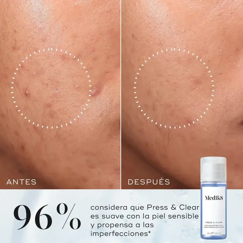 Medik8 Press & Clear, 150 ml