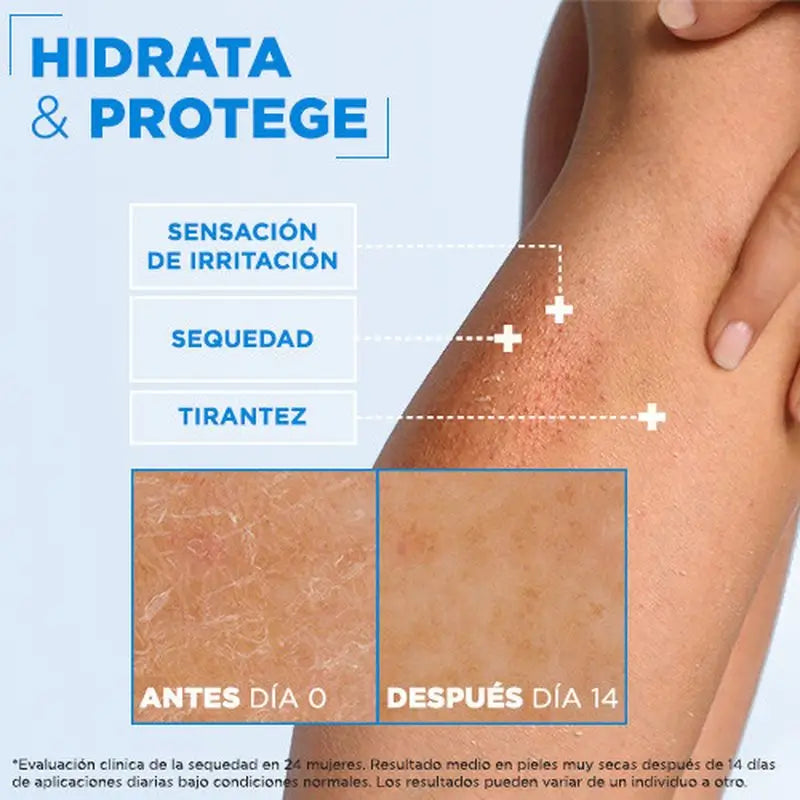 Mixa Telové mlieko Ceramide Protect pre suchú pokožku 400 ml