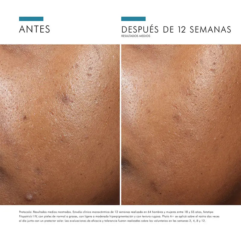 SkinCeuticals Phyto A+ rozjasňujúca kúra, 30 ml