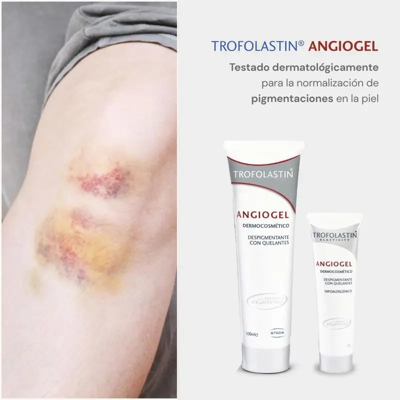 Trofolastin Angiogel – krém na odstránenie pigmentových škvŕn, 2x100 ml