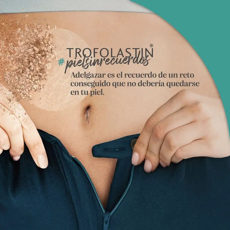 Trofolastin Krém proti striám 100 ml