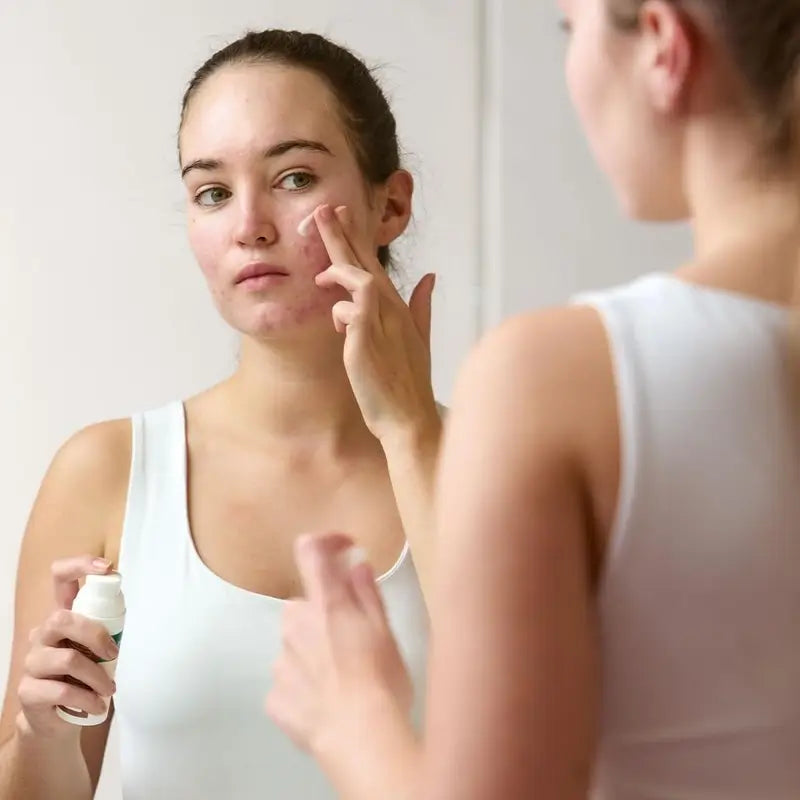 Vincobiosis Cremigel na tvár na vyrovnanie pokožky, 50 ml